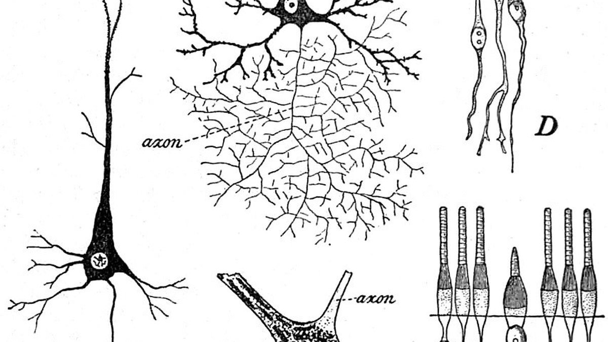 Classic neuron histology — soma, dendrites and axon of the nerve-cell class HDAP2 protects — Panacea Bio Chem